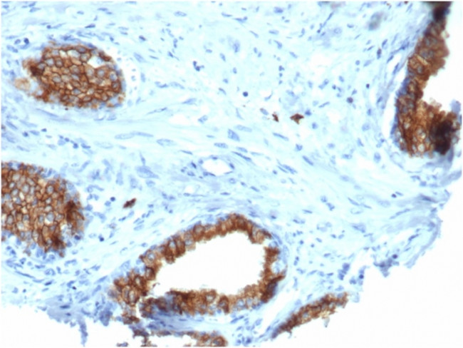 CD38 (ADP Ribosyl Cyclase I) Antibody in Immunohistochemistry (Paraffin) (IHC (P))