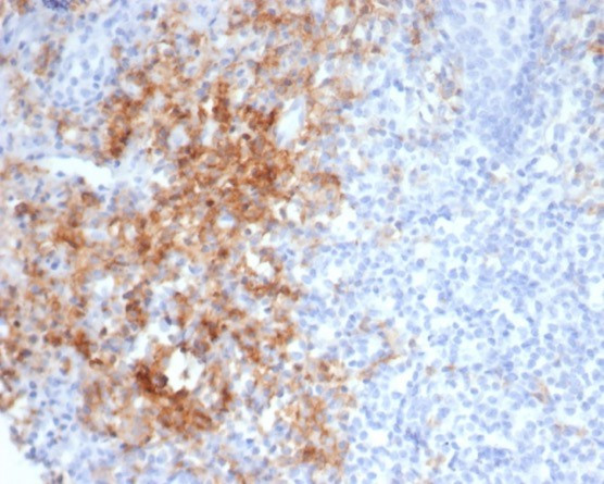 CD38 (ADP Ribosyl Cyclase I) Antibody in Immunohistochemistry (Paraffin) (IHC (P))
