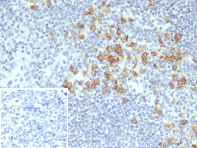 CD38 (ADP Ribosyl Cyclase I) Antibody in Immunohistochemistry (Paraffin) (IHC (P))