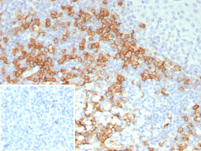 CD38 (ADP Ribosyl Cyclase I) Antibody in Immunohistochemistry (Paraffin) (IHC (P))