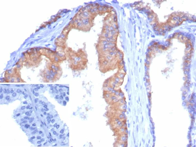 CD38 (ADP Ribosyl Cyclase I) Antibody in Immunohistochemistry (Paraffin) (IHC (P))