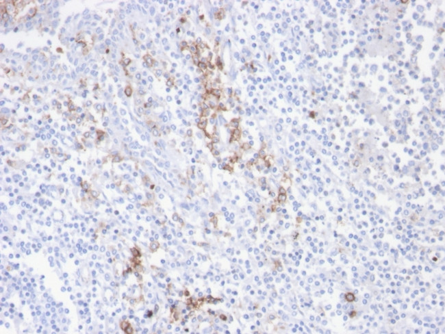 CD38 (ADP Ribosyl Cyclase I) Antibody in Immunohistochemistry (Paraffin) (IHC (P))