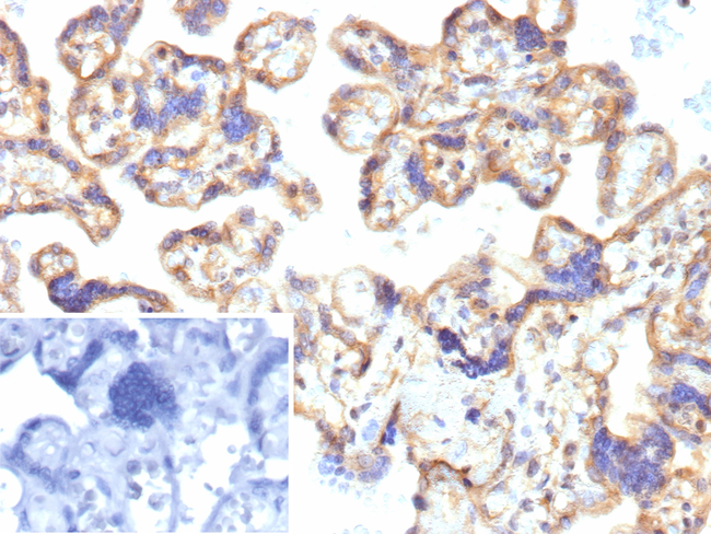 CD39/ENTPD1 (Marker of Tumor-specific T cells) Antibody in Immunohistochemistry (Paraffin) (IHC (P))