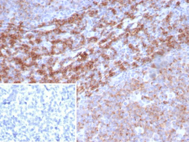 CD39 Antibody in Immunohistochemistry (Paraffin) (IHC (P))