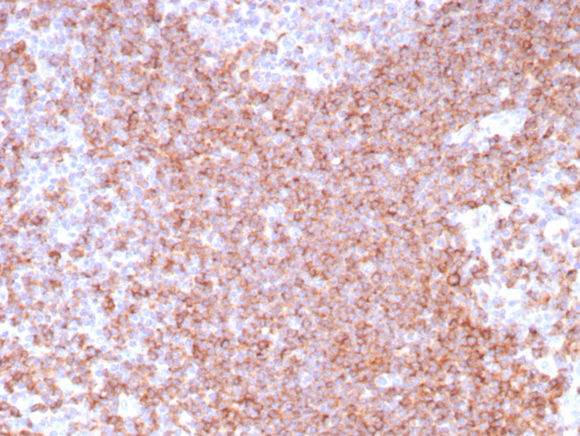 CD39 Antibody in Immunohistochemistry (Paraffin) (IHC (P))