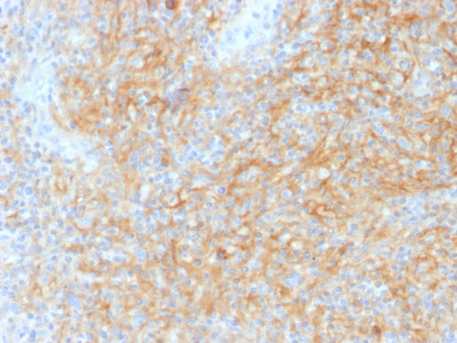 CD40/TNFRSF5/CD40L-Receptor Antibody in Immunohistochemistry (Paraffin) (IHC (P))