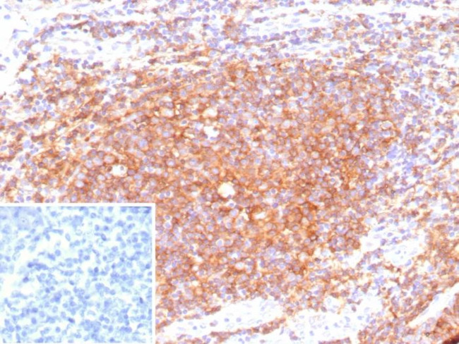 CD40/TNFRSF5/CD40L-Receptor Antibody in Immunohistochemistry (Paraffin) (IHC (P))