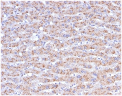CD40 Ligand/CD154/TRAP1 (Activation Marker of T-Lymphocytes) Antibody in Immunohistochemistry (Paraffin) (IHC (P))