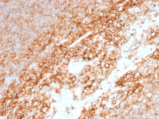CD44/HCAM Std Antibody in Immunohistochemistry (Paraffin) (IHC (P))