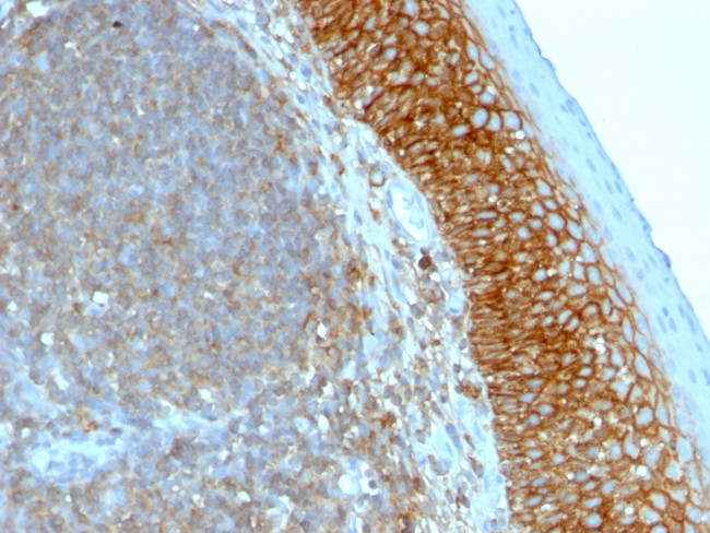 CD44/HCAM Std Antibody in Immunohistochemistry (Paraffin) (IHC (P))