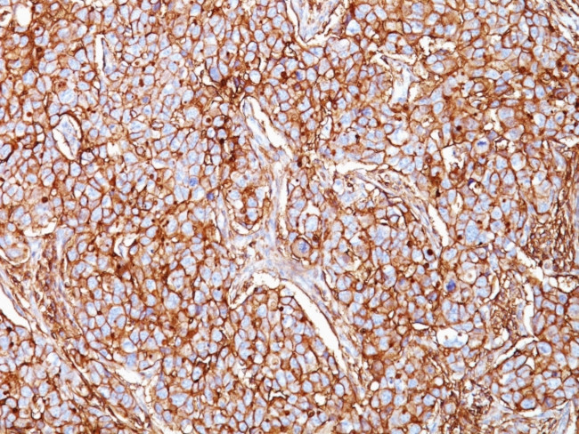CD44/HCAM Std Antibody in Immunohistochemistry (Paraffin) (IHC (P))