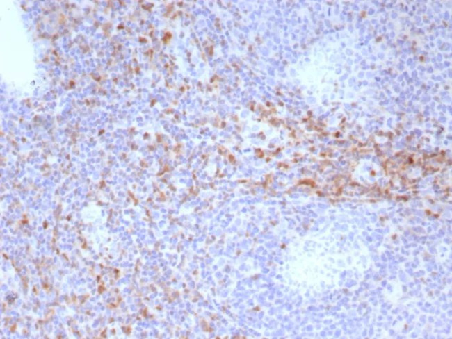 CD44 Antibody in Immunohistochemistry (Paraffin) (IHC (P))