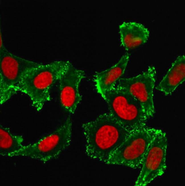CD44/HCAM Std Antibody in Immunocytochemistry (ICC/IF)