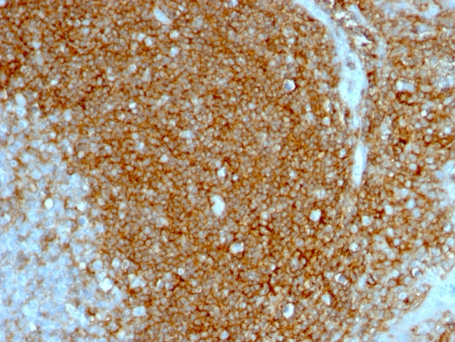 CD44/HCAM Std Antibody in Immunohistochemistry (Paraffin) (IHC (P))