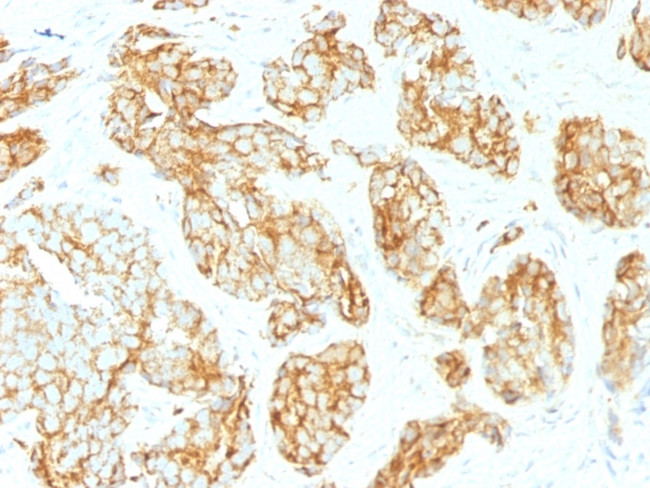 CD44v9 (Marker of Tumor Metastasis) Antibody in Immunohistochemistry (Paraffin) (IHC (P))