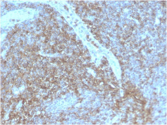 CD44/HCAM Std. Antibody in Immunohistochemistry (Paraffin) (IHC (P))