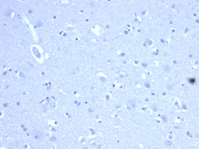 CD44/HCAM Std (Cancer Stem Cell Marker) Antibody in Immunohistochemistry (Paraffin) (IHC (P))