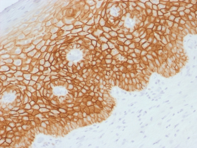 CD44v4 (Marker of Tumor Metastasis) Antibody in Immunohistochemistry (Paraffin) (IHC (P))