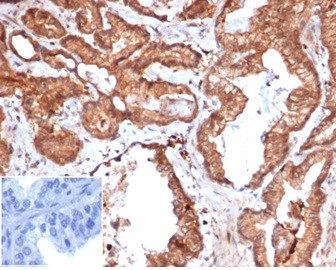 CD47/IAP (Integrin Associated Protein) Antibody in Immunohistochemistry (Paraffin) (IHC (P))