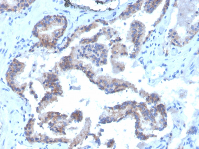 CD47/IAP (Integrin Associated Protein) Antibody in Immunohistochemistry (Paraffin) (IHC (P))