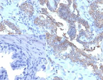 CD47/IAP (Integrin Associated Protein) Antibody in Immunohistochemistry (Paraffin) (IHC (P))
