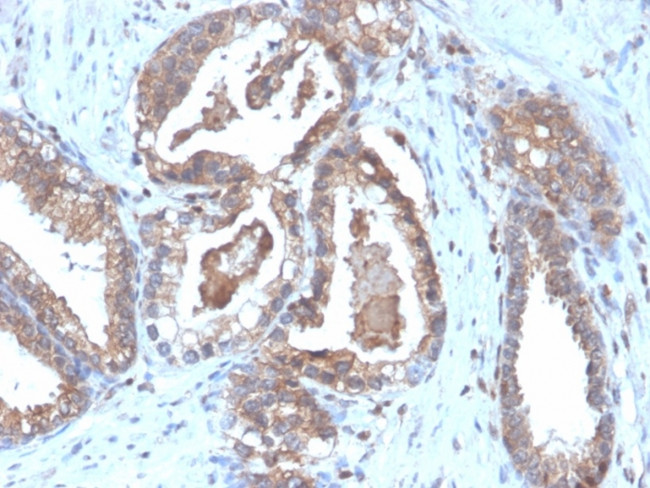 CD47/IAP (Integrin Associated Protein) Antibody in Immunohistochemistry (Paraffin) (IHC (P))