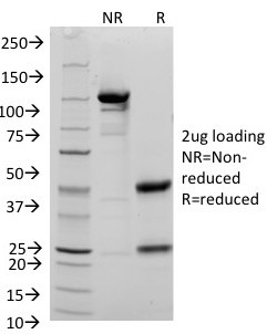 CD48 (Pan Leukocyte Marker) Antibody in SDS-PAGE (SDS-PAGE)