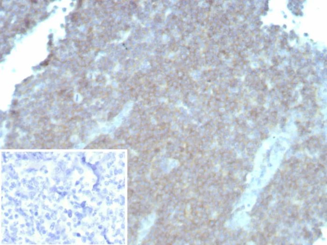 CD48 (Pan Leukocyte Marker) Antibody in Immunohistochemistry (Paraffin) (IHC (P))