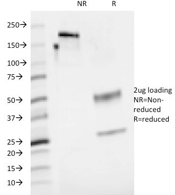 CD48 (Pan Leukocyte Marker) Antibody in SDS-PAGE (SDS-PAGE)