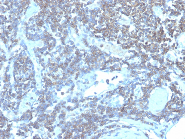 CD48 (Pan Leukocyte Marker) Antibody in Immunohistochemistry (Paraffin) (IHC (P))