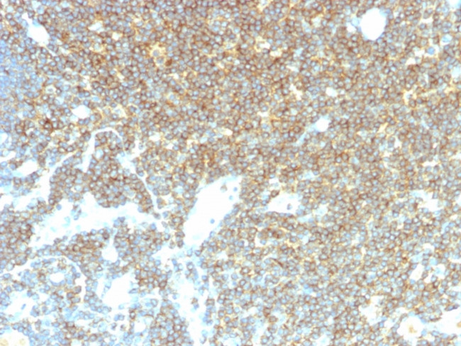 CD48 (Pan Leukocyte Marker) Antibody in Immunohistochemistry (Paraffin) (IHC (P))