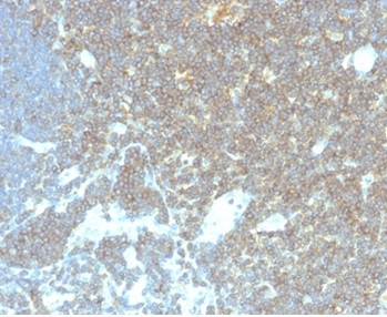 CD48 (Pan Leukocyte Marker) Antibody in Immunohistochemistry (Paraffin) (IHC (P))