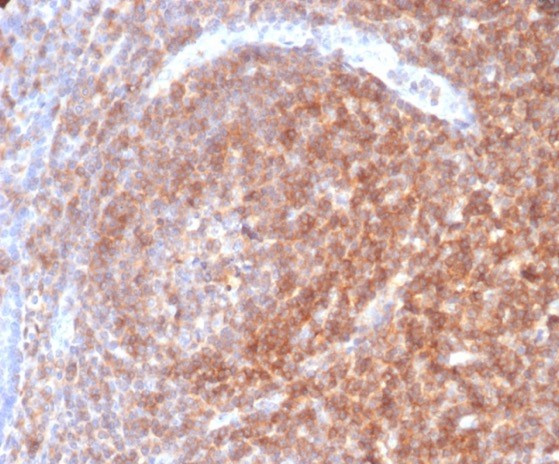 CD48 (Pan Leukocyte Marker) Antibody in Immunohistochemistry (Paraffin) (IHC (P))