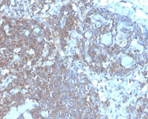 CD48 (Pan Leukocyte Marker) Antibody in Immunohistochemistry (Paraffin) (IHC (P))