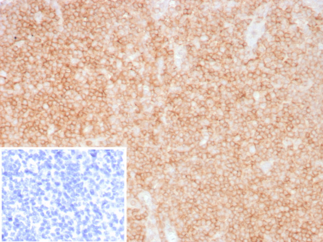 CD48 (Pan Leukocyte Marker) Antibody in Immunohistochemistry (Paraffin) (IHC (P))