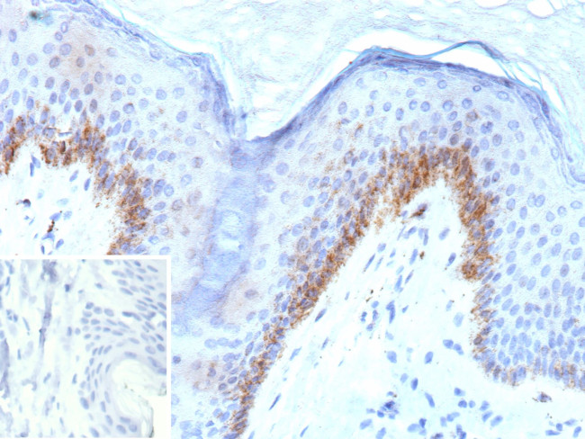 KLK4/Kallikrein related peptidase 4 Antibody in Immunohistochemistry (Paraffin) (IHC (P))