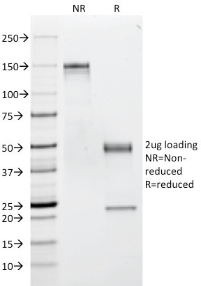 CD53 (TSPAN25) Antibody in SDS-PAGE (SDS-PAGE)