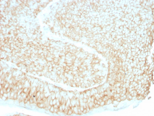 CD59/Complement Regulatory Protein/Protectin Antibody in Immunohistochemistry (Paraffin) (IHC (P))