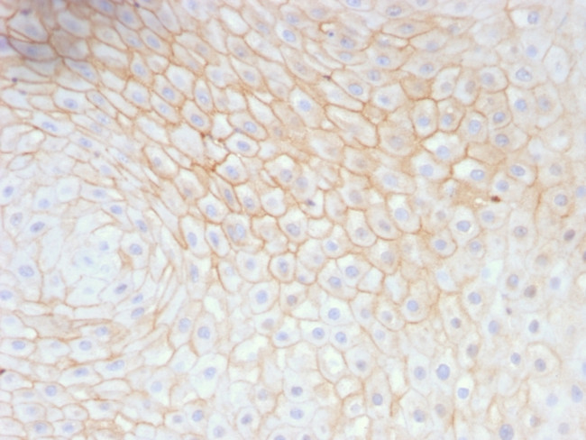 CD59/Complement Regulatory Protein/Protectin Antibody in Immunohistochemistry (Paraffin) (IHC (P))