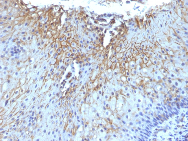 CD59/Complement Regulatory Protein/Protectin Antibody in Immunohistochemistry (Paraffin) (IHC (P))