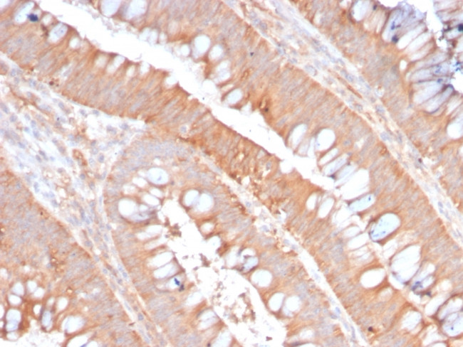 CD59/Complement Regulatory Protein/Protectin Antibody in Immunohistochemistry (Paraffin) (IHC (P))