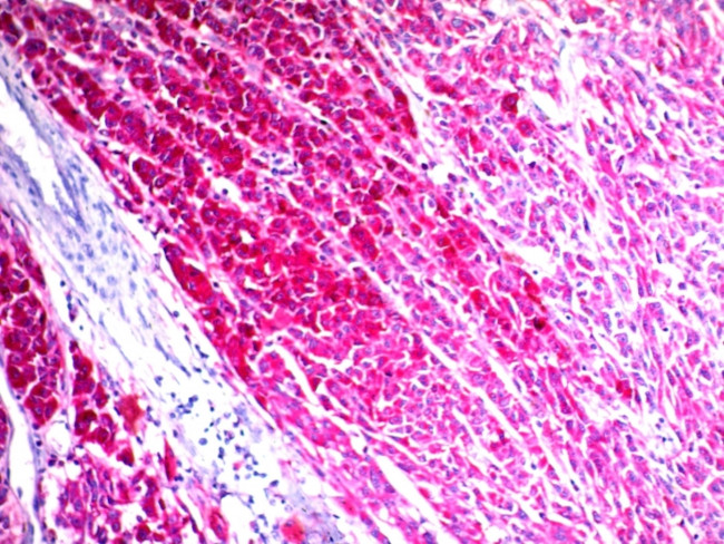 CD63 (Late Endosomes Marker) Antibody in Immunohistochemistry (Paraffin) (IHC (P))