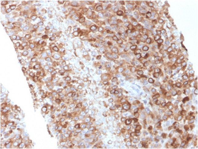 CD63 Antibody in Immunohistochemistry (Paraffin) (IHC (P))