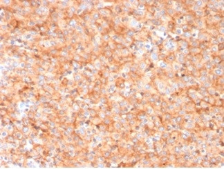 CD63 (Late Endosomes Marker) Antibody in Immunohistochemistry (Paraffin) (IHC (P))