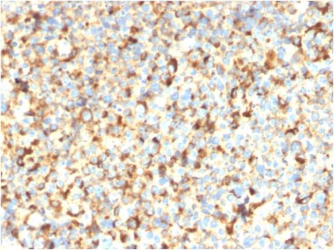 CD63 Antibody in Immunohistochemistry (Paraffin) (IHC (P))
