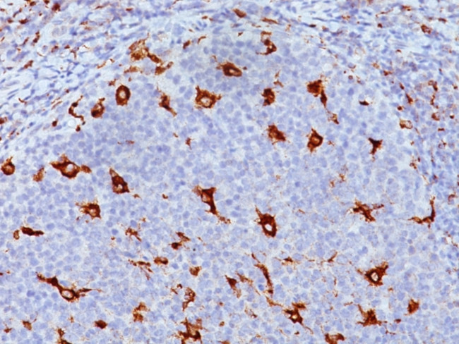 CD68 (Macrophage Marker) Antibody in Immunohistochemistry (Paraffin) (IHC (P))