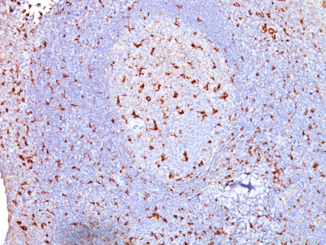 CD68 (Macrophage Marker) Antibody in Immunohistochemistry (Paraffin) (IHC (P))