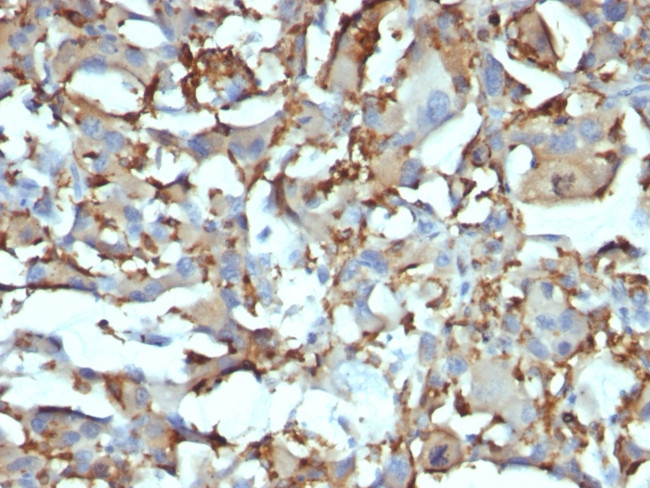 CD68 (Macrophage Marker) Antibody in Immunohistochemistry (Paraffin) (IHC (P))