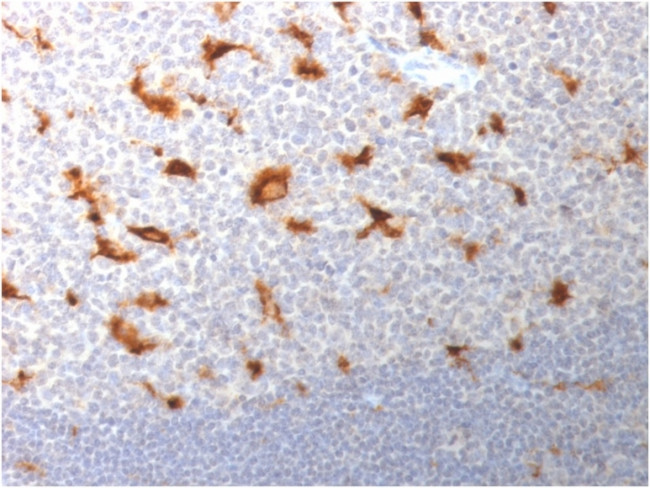 CD68 (Macrophage Marker) Antibody in Immunohistochemistry (Paraffin) (IHC (P))