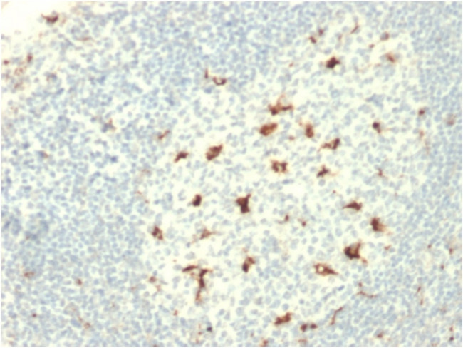 CD68 (Macrophage Marker) Antibody in Immunohistochemistry (Paraffin) (IHC (P))